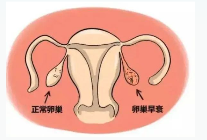 喜得贝贝：试管婴儿促排卵的次数多这会不会导致卵巢功能衰退？