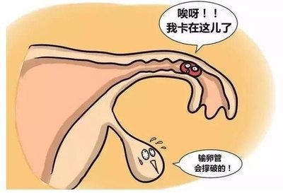 t01a62ae1ed00bb06b0.jpg