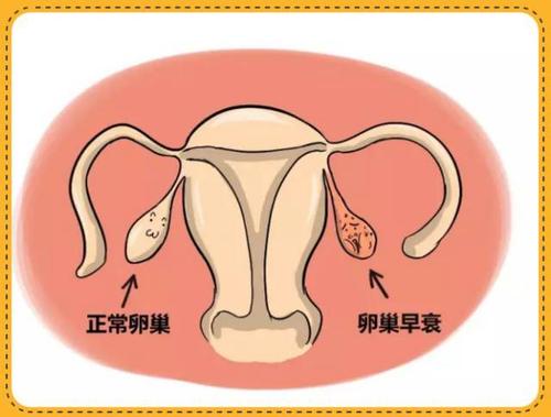 喜得好孕：在高龄备孕期间，应该关注哪些潜在风险？