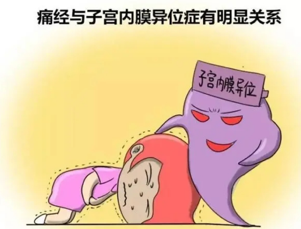 喜得贝贝：子宫内膜异位症的诊断和原因？